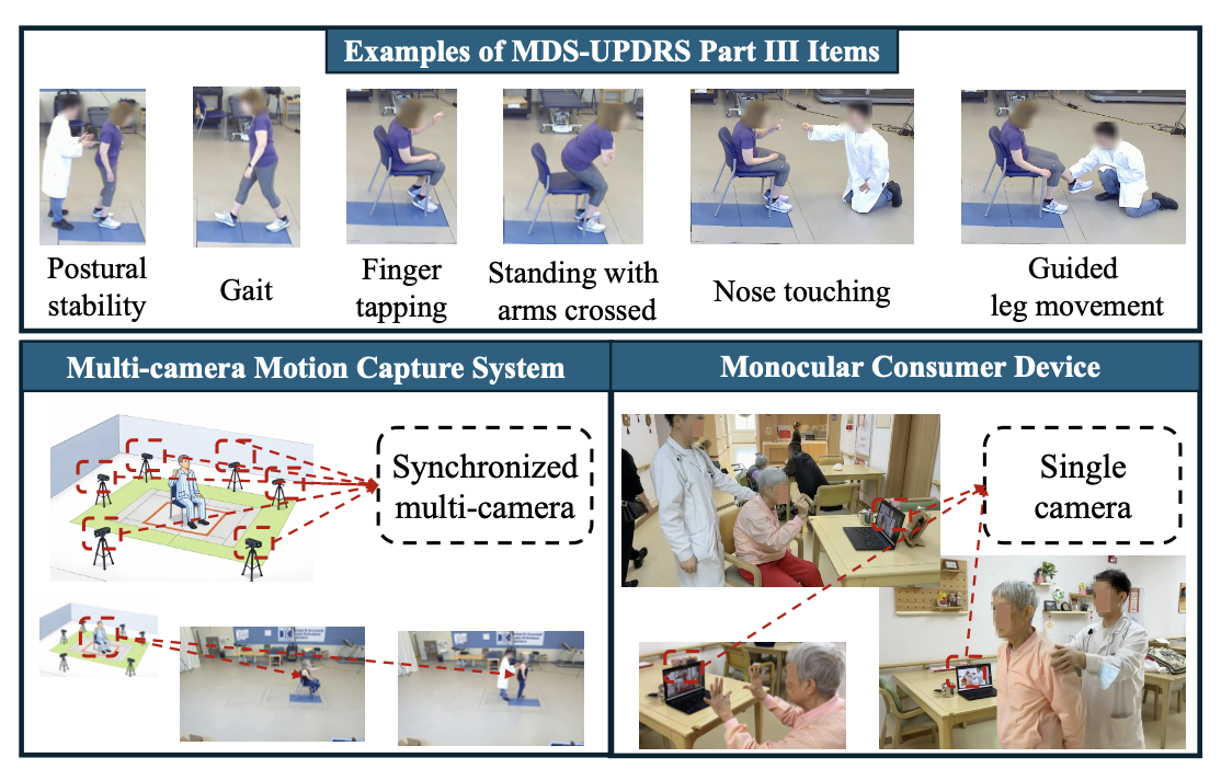 TulipTender: A Mobile 3D Parkinson's Disease Assessment System Using a Single Camera